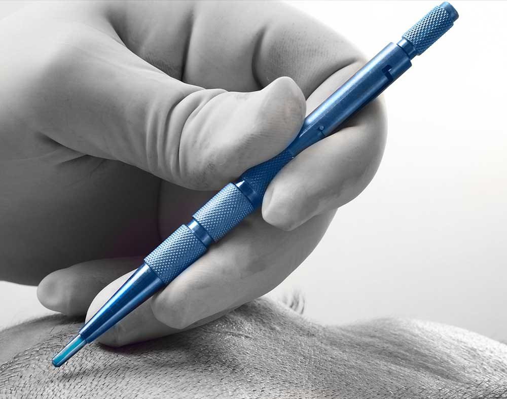 Sapphire FUE Hair Transplant