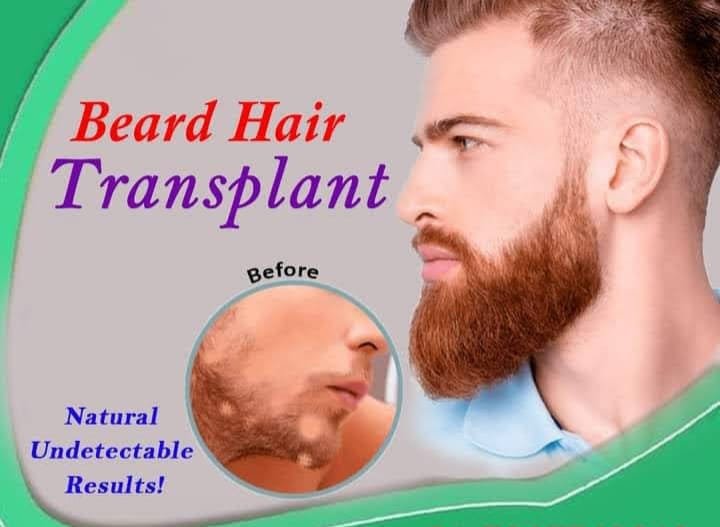 Beard Hair Transplant